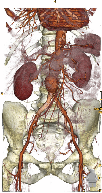 \includegraphics[width=10cm]{results/images/abdomen.eps}