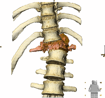 \includegraphics[width=10cm]{results/images/spine00.eps}